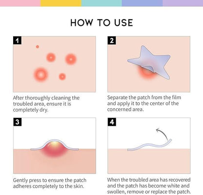 180 Pcs Pimple Patches